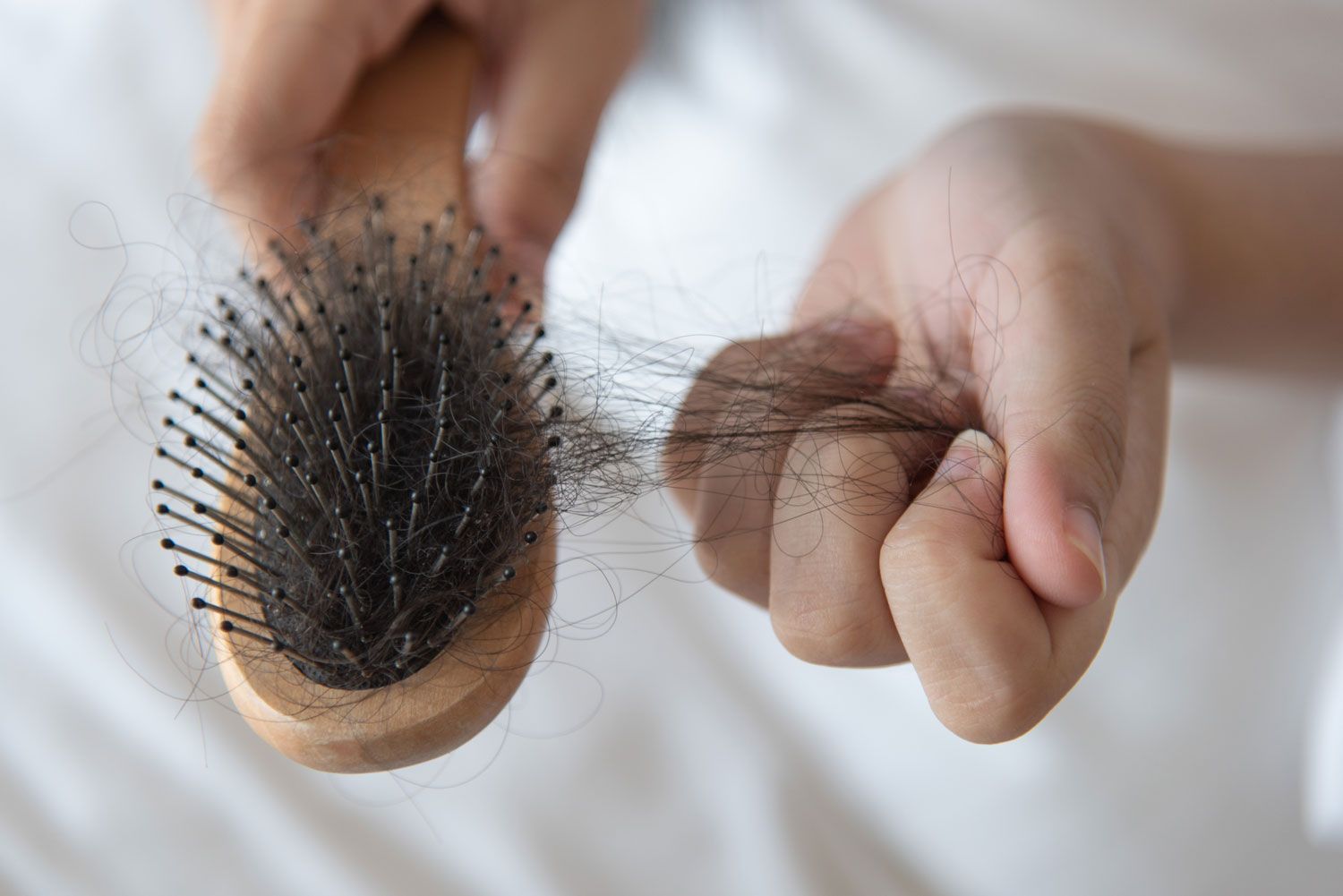 For-hair-loss-perte-cheveux For-hair-loss-perte-cheveu