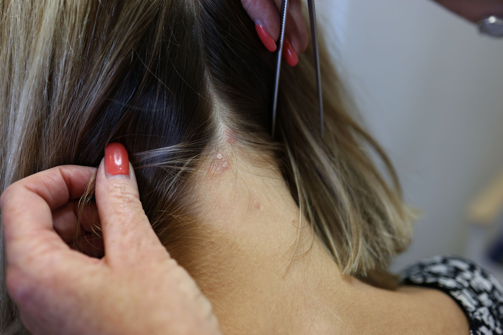 Centre-capillaire-for-hair-loss
